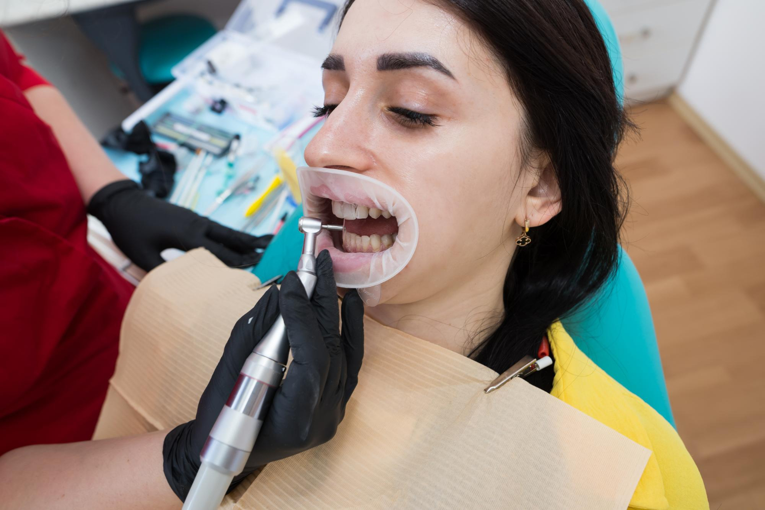 Full Mouth Rehabilitation